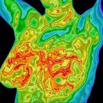 Breast thermography as part of a woman’s breast health care