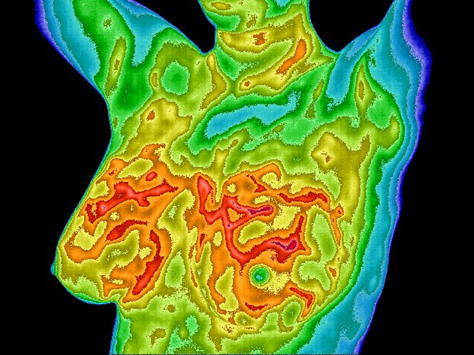 You are currently viewing Breast thermography as part of a woman’s breast health care