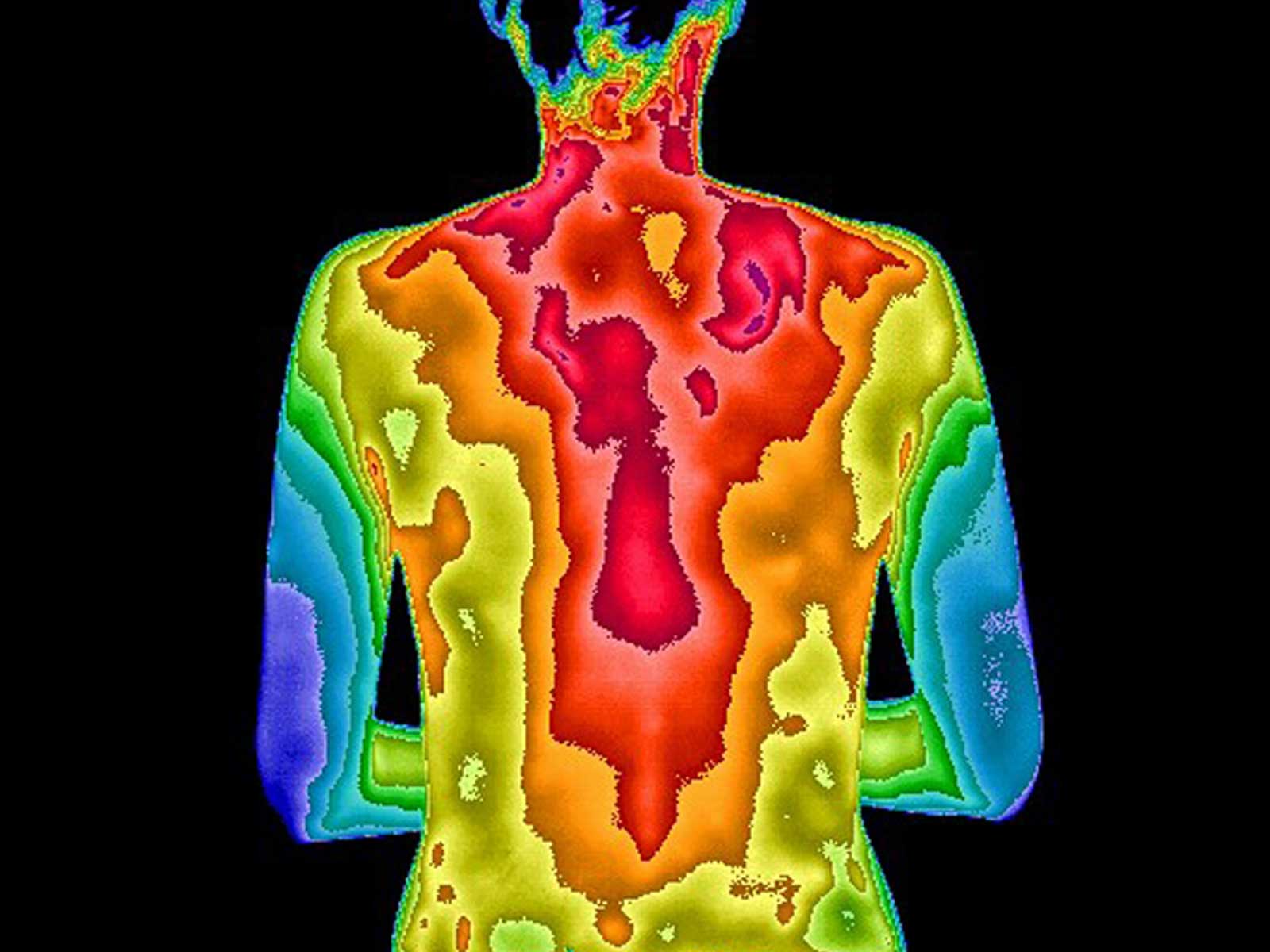 Thermogram of back